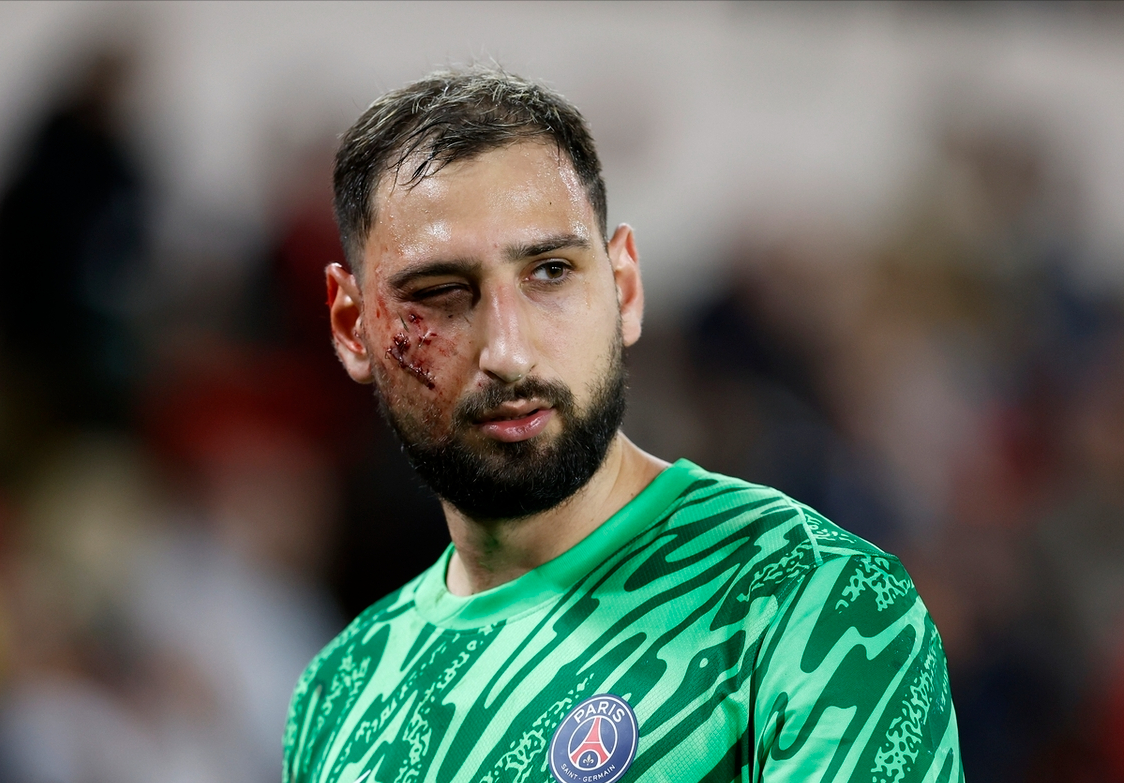 摩纳哥遭遇惨败，法甲竞争激烈升温的简单介绍